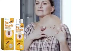 XIMONTH Racun Lebah Kutil Perawatan Semprot untuk Meningkatkan Daging Daging Tahi Lalat Perbaikan Kulit Semprot Kutil XIMONTH Bee Venom Cloth Care Spray Improving Meat Grains Meat Mole Repair Smooth Skin Cloth Spray