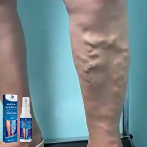 Varicose vein spray to smooth out bulging veins in the legs and relieve phlebitis spider angiomas and capillary vasculitis. 30 ml