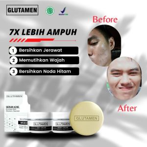 KHUSUS PRIA !! glutamen Skincare wajah pria pemutih glowing Cream pencerah wajah pria Krim pemutih glowing cepat Obat pemutih kulit permanen pria bpom Krim pemutih pria glowing asli bpom Serum bpom bikin glowing pria Brightly Ever After Day Cream