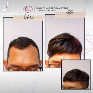Ryuuta Wig Toupee Clip Poni Penutup Botak Pendek 011492