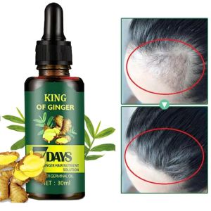 Obat Penumbuh Rambut / Anti Rontok Botak Ginger Germinal Oils 7 Days Aman Ampuh Menumbuhkan Rambut Rontok Dan Botak