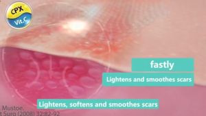 100% Effective Scar Remover Cream For Old Scar On Leg Stretch Mark Remover Acne Scar Remover Cream Reduce Deep Scars & Post-Surgery Scars