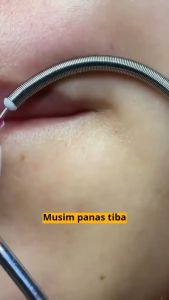 alat penghilag bulu halus di wajah