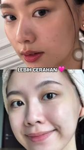 ISWHITE BRIGHTENING SERIES | Paket Skincare Untuk Mencerahkan Kulit dan Menyamarkan Noda Hitam | Halal BPOM