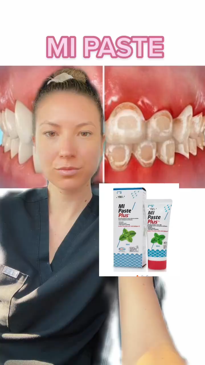 [GOKO] GC Tooth Mousse with RECALDENT CPP-ACP Strengthen Enamel Prevent Cavities Sensitive Teeth Relief for Kids Adults