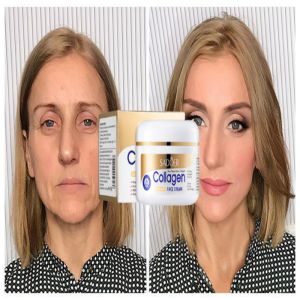 🔥Orfila Collagen Face Cream 100g Whitening Moisturizing Anti-wrinkle Lighten Dark Spots Anti aging Natural Brightening Melasma Removal Cream Repair Damaged Skin Moisturizer Cream for Face Skin Care