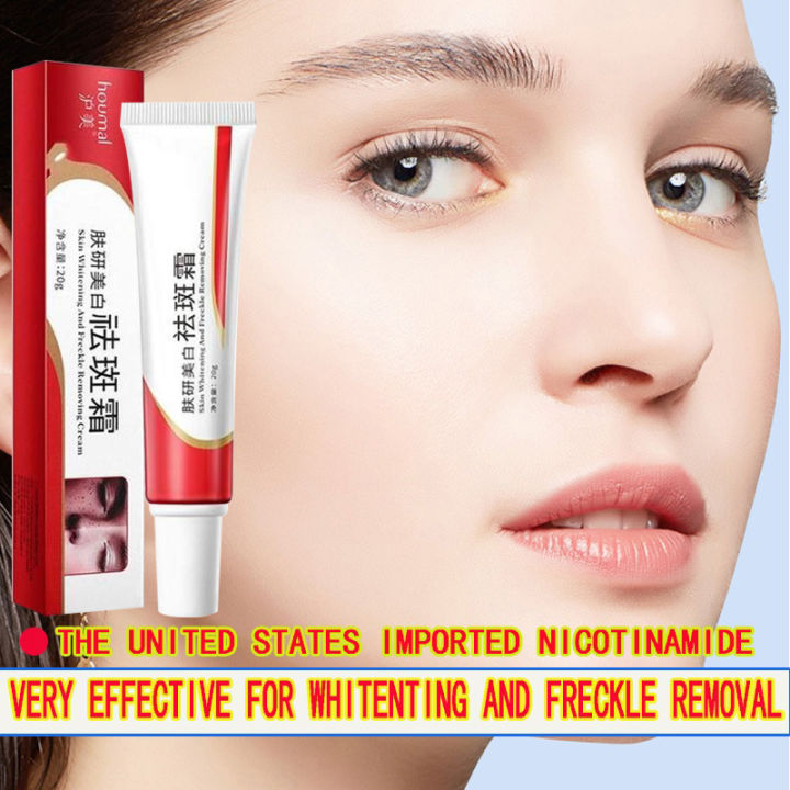 Original Whitening Freckle Cream Pekas Remover FOR ALL SKIN TYPES Melasma Remover Oitment Melasma Cream Pantanggal ng Pekas Pantanggal ng Melasma