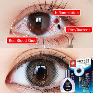 Eye Problems Eye Drops Myopia Astigmatism Eye Drops Relieve Visual Fatigue Dry Eyes Conjunctivit Cataract