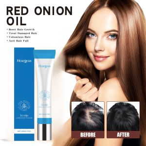 [Anti-Hair Loss Promote Hair Growth] Hair Care Essence Roll-On Moisture Repair Strengthen Hair Follicles Scalp Conditioner