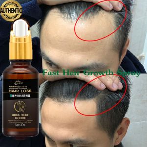 Serum Penumbuh Rambut Botak Cepat Serum Rambut Rontok Penumbuh Rambut Cepat Anti Rontok 30ml