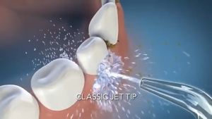 MYSET Xiaomi Water Flosser 2 | 3 Flossing mode | 200mL Large Water Tank 90 Day Battery Life Electric Water Flosser Teeth