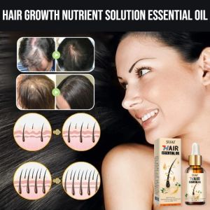 Hair Growth Nutrient Solution Essential Oil Hair Growth Solution Anti-Hair Loss Moisturize Smoothing Serum Hair Care Product