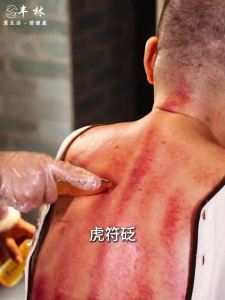 Dụng Cụ Massage Gua Sha Bằng Thép Không Gỉ Y Tế Dụng Cụ Cạo Thủ Công Giải Phóng Mô Cơ Trị Liệu Vật Lý Giảm Đau