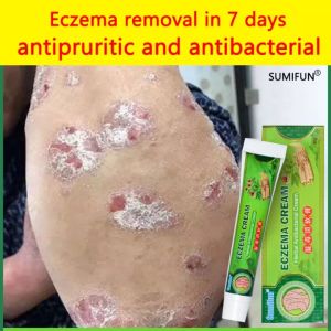 Original Psoriasis Cream Skin Care Cream Psoriasis Skin Cream Dermatitis Eczematoid Eczema Ointment Treatment 20g Psoriasis Eczema Itchiness Organic Skin Ointment Natural Herbal Multi Plant Extract Anti Bacterial Anti Fungal 👍