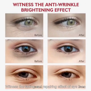 LIFUSHA VERFONS Eye Cream: Solusi Krim Mata Anti Keriput & Perawatan Kulit Anti-Bengkak