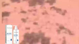 West&Month  Brightening and Moisturizing Body Lotion   Repair Keratosis Pilaris Prevent Dryness Smooth Skin Whitening Beauty