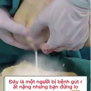 Kem xoa dịu sưng tấy Giảm đau giảm sưng do gút thẩm thấu sâu vào vùng bị gút