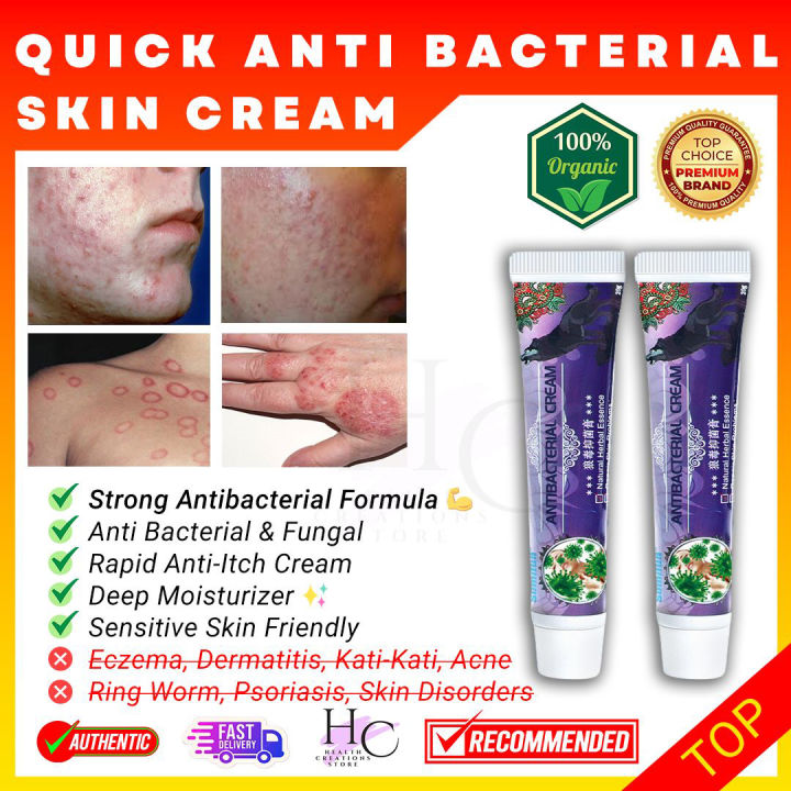 SUMIFUN Antibacterial Cream Gamot Sa Pigsa Gamot Sa Kati Kati Sa Balat ...