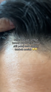 ZAEMs The Tonic Lab Scalp Refresher 50ml by Zaem for hair loss dandruff and hair volumising