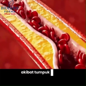 Cardiosure Susu Herbal Atasi Darah Tinggi Kolesterol Stroke Pusing dan Gula Darah Dengan Bahan Alami