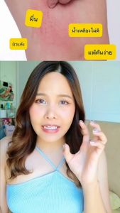 Mineral Shower สบู่เหลวน้ำแร่ สำหรับผู้มีปัยหา ผดผื่นคัน ผิวอักเสบแดง แพ้ง่าย น้ำเหลืองไม่ดี แพ้สาร