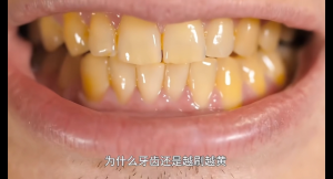 Regenerated Silicon Toothpaste Repairs Enamel & Strengthens Gums Fights Plaque Whitens Teeth Mild & Non-Irritating Suitable for Sensitive Teeth 100g