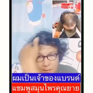 ลดปีใหม่ แชมพูสมุนไพรคุณยาย แชมพูแก้ผมร่วง หัวไม่ล้าน ลดคัน รังแค