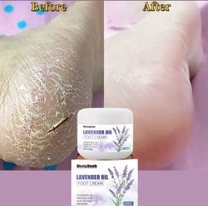 12:12BUY1GET1 Foot Cream Anti Fungal merontokkan mata ikan atau callus untuk kaki pecah2 lavender oil