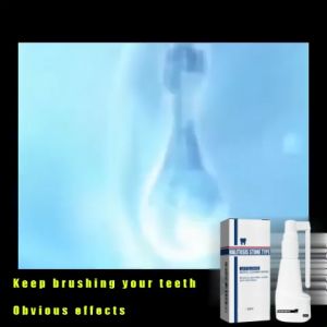 Jaysuing Tartar Dissolving Spray Teeth Whitening Spray Removes Plaque Whitens Teeth Teeth Cleaner Freshens Breath Improves Gum Health Suitable For Men And Women