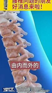Zuyitang lumbar far-infrared gel. Relieves soreness numbness pain and swelling in the waist. Targets lumbar disc herniation.