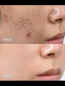 Pore Minimizer Serum 30ml acne serum brightening serum Shrink pores anti-acne brighten skin tone anti-aging moisturizing essence