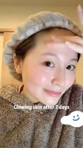 Japanese Melasma Cream 30g Replenish Collagen Whiting For Face Pekas Original Melasma Cream