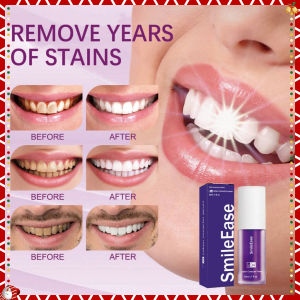 พร้อมส่ง 24ชม Hismile V34 น้ํายาฟอกสีฟัน สีม่วง，สีม่วง แก้ไขฟันขาวกระจ่างใส ดูแลฟัน ยาสีฟัน ลดสีเหลือง