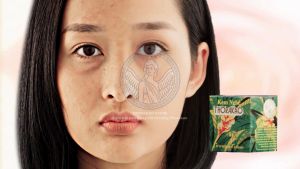 Kem Nghệ Thorakao 7g ngừa mụn trắng da giảm thâm mờ sẹo - Thorakao Store.
