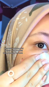 Toner Chamomille SR12: Membersihkan & Melembapkan Kulit