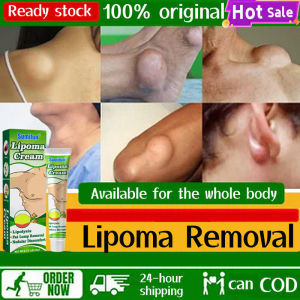 lipoma cream original lipoma removal cream 20g 脂肪瘤 ubat benjolan lipoma Natural extract Safe and effective remove Various types of Lump