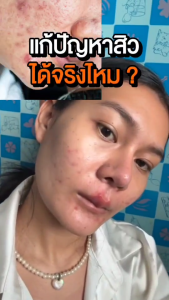(ของแท้ 100%| แพ็ค 4) SOMSAI สบู่ล้างหน้าวิตามิน ส้มใส ขวดใหญ่ 300ml อ่อนโยนแม้ผิวแพ้ง่าย