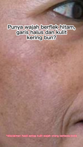 Cream Flek Hitam Ampuh BPOM Krim Flek Hitam Membandel Criem Flek Hitam Tebal BPOM Memudarkan Flek HItam di Wajah Leika Skincare Flek Hitam