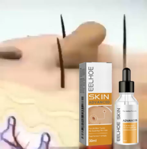 EELHOE Wart Treatment Essence Deep Cleansing Smooth Skin Lightening Hand Foot Corns Warts Treatment Essence