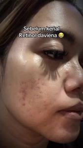 COD GRATIS ONGKIR DAVIENA RETINOL SLEEPING MASK RETINOL BOOSTER UNTUK MENCERAHKAN SKINCARE ORIGINAL BPOM ASLI