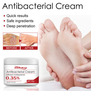 Psoriasis Treatment Cream Relieve Itchy Skin Repair Hand and Foot Moss Body Itch Relief Cream