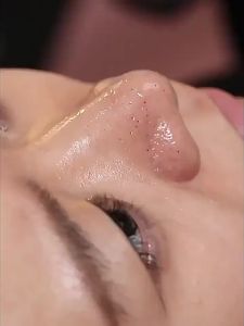 FANGXIANG | Blackhead Remover and Pore Tightening Solution
