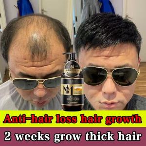 hair loss shampoo hair growth shampoo 何首烏洗發水 400ml Oil control anti-dandruff anti-hair loss hair growth Herbal Polygonum multiflorum shampoo