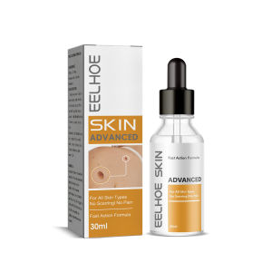 Eelhoe Warts Removal Essence Neck Face Warts Moles Skin Tag Removal Serum Painless Whitening Mole Warts Black Spots Removal Lqiuid Lighten Skin Tags Mositurzing Whitening Wart Remover Solution(30ml)