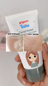 PIGEON TEEN Facial Foam Deep Cleansing & Oil Control with Charcoal Alcohol Free Non Perfume