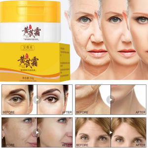 Ready stock original astragalus cream anti aging dark spot remover freckles pigmentation remover melasma care krim jeragat paling berkesan50g黄芪霜
