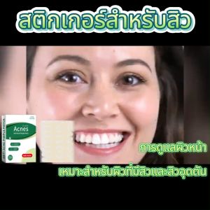 แผ่นแปะสิว   เหมาะสำหรับสิวผิวสิวดูแลผิวหน้าแบบพกพาปกปิดสิว