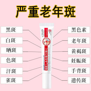 A Genuine Goods Despeckle Cream Special Treatment for Removing Senile Plaque Ointment Strong Removal of Face for Hands Hands and Back