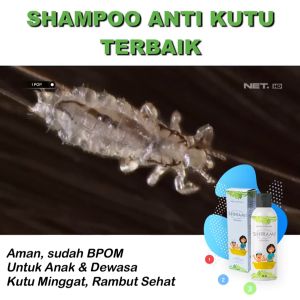 SHIRAMI SHAMPOO Ampuh Untuk Membasmi Kutu Hingga Telurnya