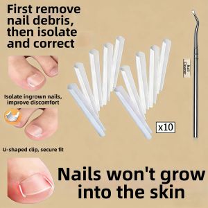 Ingrown Toenail Corrector Isolating Spacer Pad